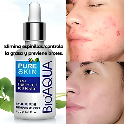 🔥 Sérum Antiacné Bioaqua x1 | Piel limpia, fresca y sin imperfecciones todos los días 💧